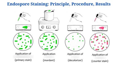 endospore stain results|7.3: Endspore Procedures and Results .